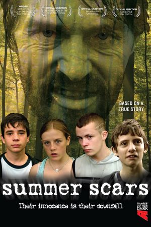 Image Summer Scars – Der Film