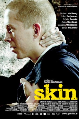 Image Skin - Hass war sein Ausweg – Der Film